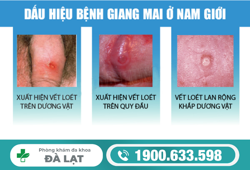 Hình ảnh minh họa